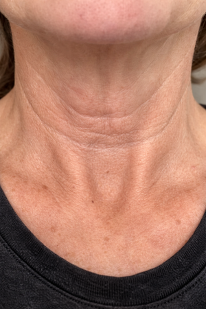 42_portrait_200x300_week_1_neck.png