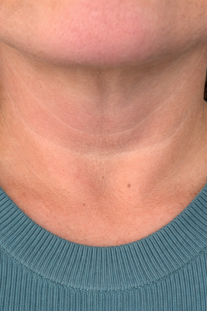 43_portrait_200x300_week_3_neck_c2168367-cc59-4da2-96ca-b865.png