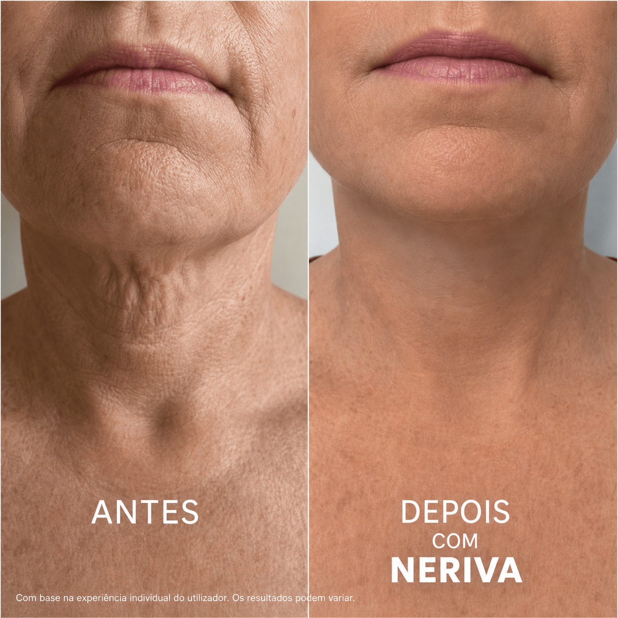 Creme firmador e lifting para o Pescoço e Colo