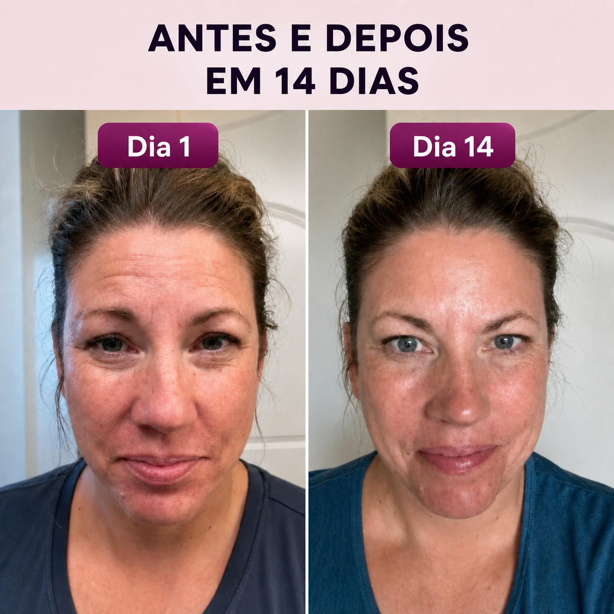 Efeito Lifting Imediato: Rosto, Olhos e Pescoço