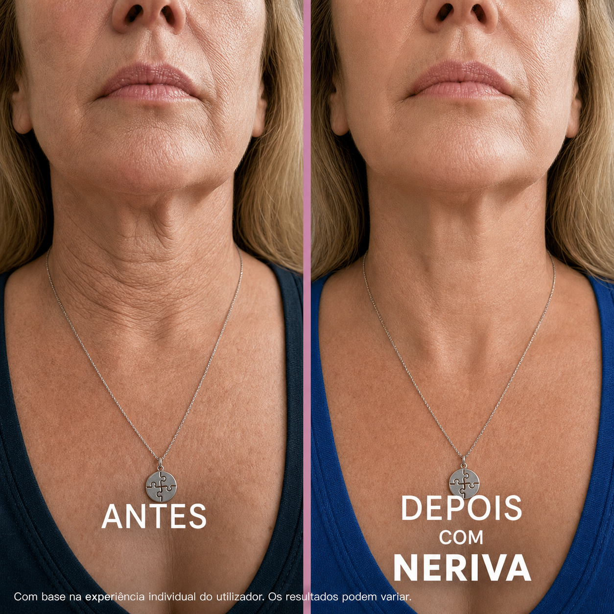 Creme firmador e lifting para o Pescoço e Colo