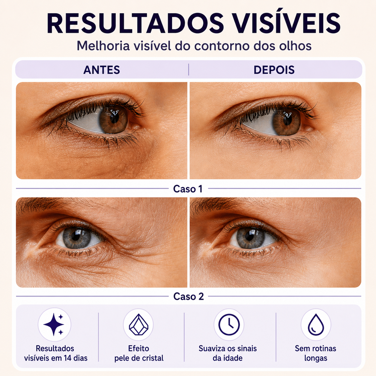 Efeito Lifting Imediato: Rosto, Olhos e Pescoço