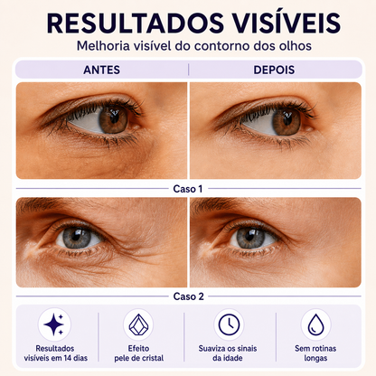 Efeito Lifting Imediato: Rosto, Olhos e Pescoço