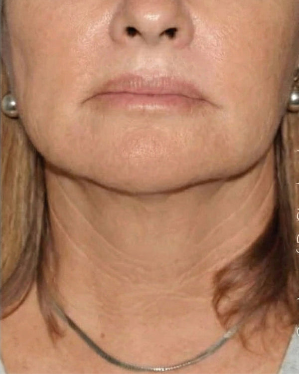 pesoperdido-3-DESPUES-13_semanas.jpg